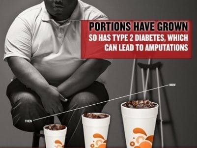 IMB_obesity-ad1